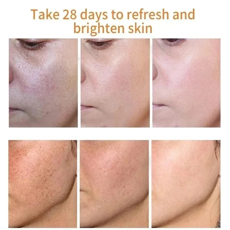 Fades Freckle Dark Spots Face Cream Niacinamide Whitening Cream Vitamin E Improve Dullness Fast Brighten Nourish Skin Care